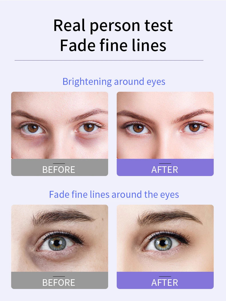 Anti-Wrinkle Eye Cream with Roller Ball – Hydrating Hyaluronic Acid Serum for Fine Lines & Puffiness