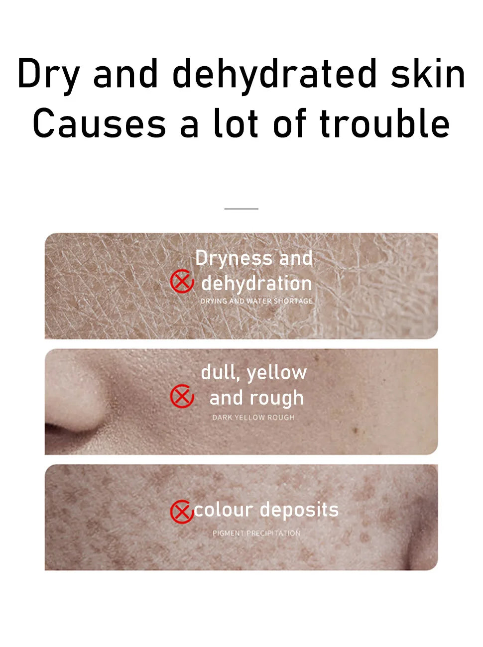 Rice Extract Skincare Set – Toner, Niacinamide Serum & Cleansing Foam