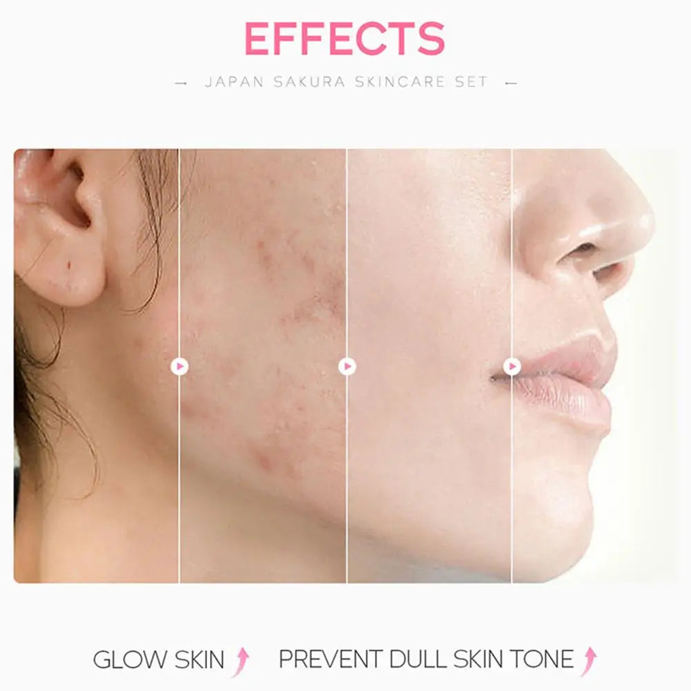 Sakura Skincare Set – 3/5-Piece Face Care Kit with Toner, Serum, Cream & More